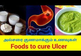 வயிற்றுப்புண்ணை குணமாக்கும் உணவுகள் | Foods to cure Ulcer | Home remedy for ulcer