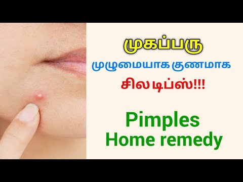 முகப்பரு குணமாக உணவு முறை  | Simple home remedy for Pimple and Acne