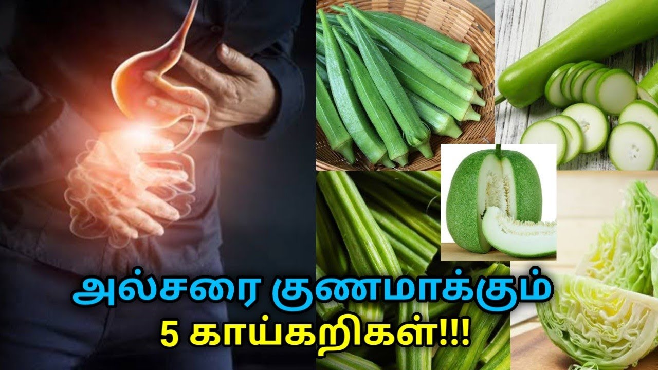 அல்சரை குணமாக்கும் ஐந்து காய்கறிகள் | Vegetables for ulcer treatment